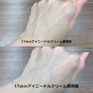 17skinアイニードルクリーム　ビフォーアフター