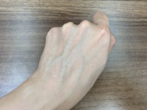 アンリンクル　ビフォー