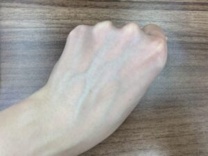 アンリンクル　アフター